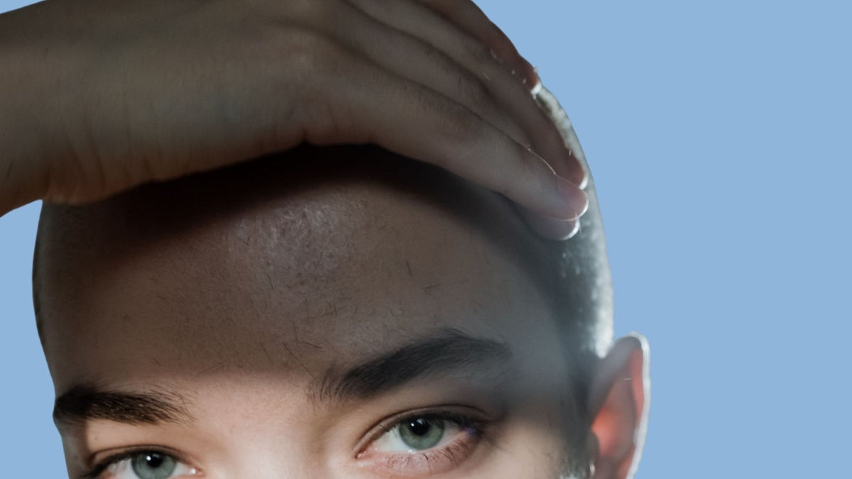 How to Avoid & Fix Irritated Skin from Wig Glue & Hair System Adhesives