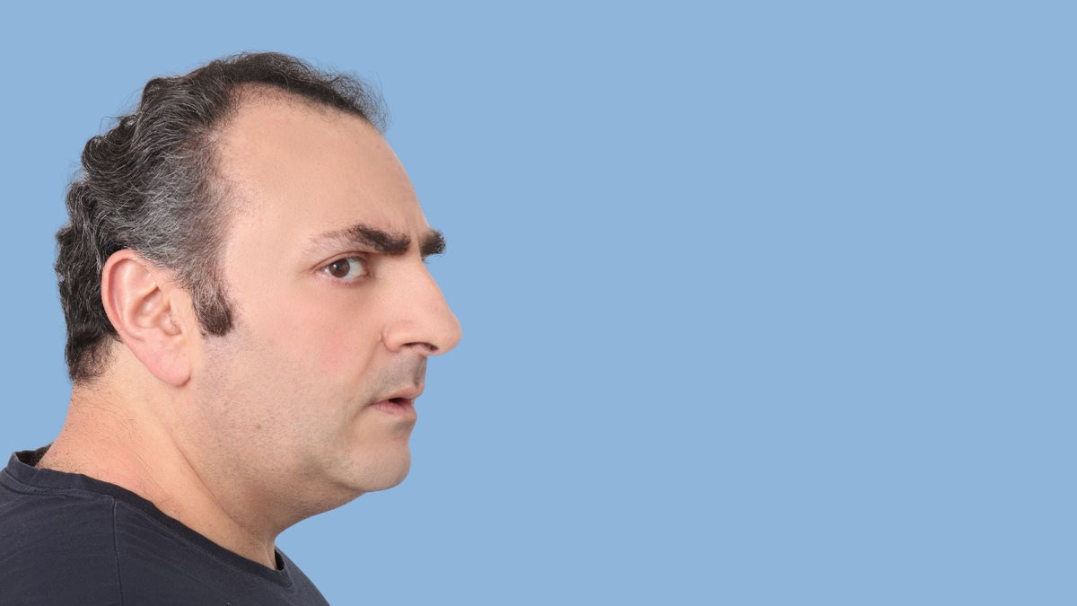 Not Ready for Hair Transplant Surgery? Why a Hair System Is a Smart First Step