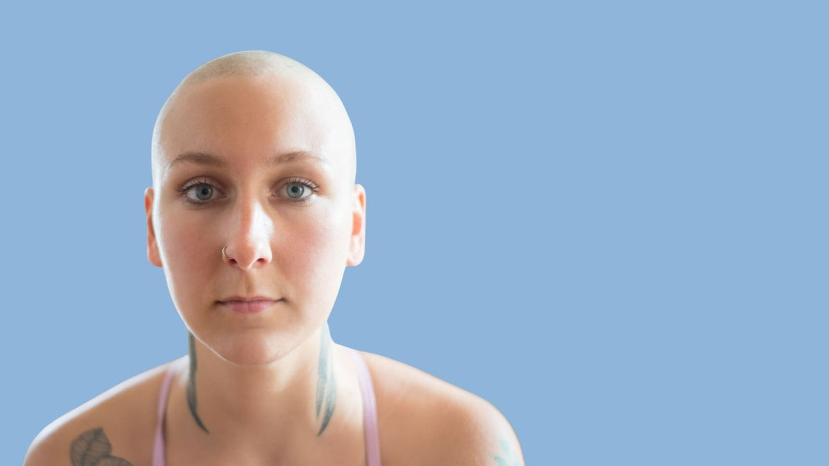 Why Hair Loss Support Matters (and Where to Find It)